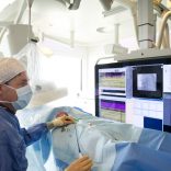 Aanpassing leefstijl verbetert behandeluitkomst boezemfibrilleren