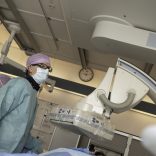 Kans op beroerte aanzienlijk kleiner in Catharina Ziekenhuis door nieuwe techniek