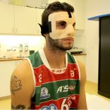 Pereiro in voetsporen Depay met bestralingsmasker uit Catharina Kanker Instituut