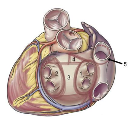 CTC 010 Mine Maze 2.png
