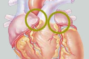 CTC 010 Mine Maze 3.jpg