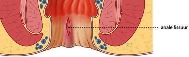 CHI060 fissuur-folder 27-05-2014 def.jpg