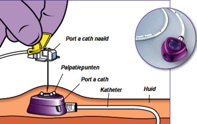 CKI-014 afbeelding 1.png