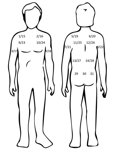 GER-012Plaatsen rivagstigmine pleister.jpg