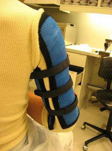 Humerus brace, figuur 2.0.JPG