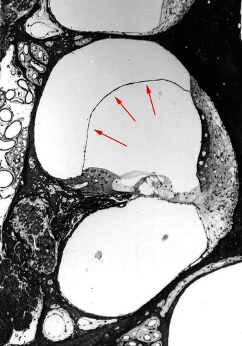 KNO-039 afbeelding 4.png
