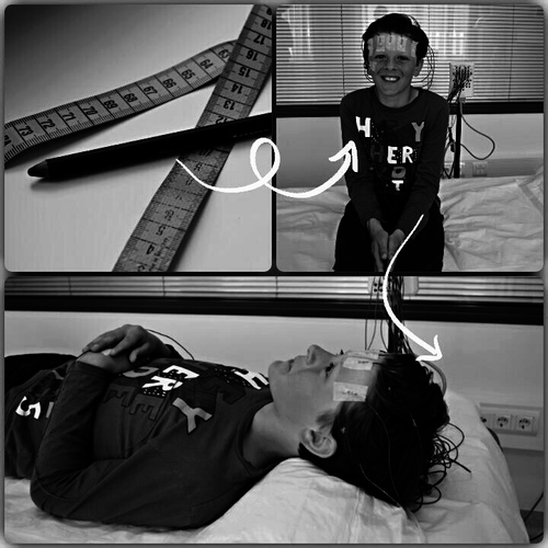 Losse elektroden.jpg