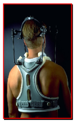 ORT025 afbeelding Haloframe.bmp