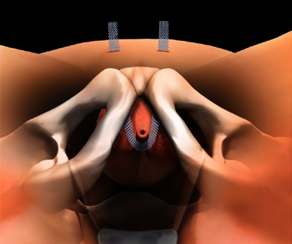 URO-004 afbeelding 1 nieuw.jpg