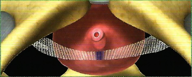 URO-004 afbeelding 2 nieuw.jpg