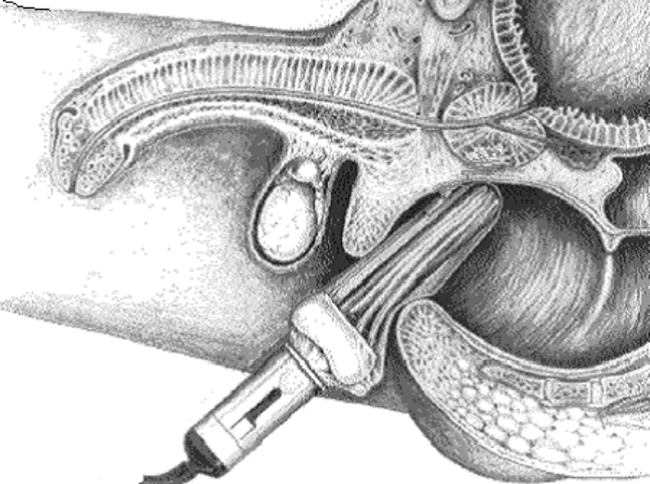 URO016 echografie prostaat.bmp