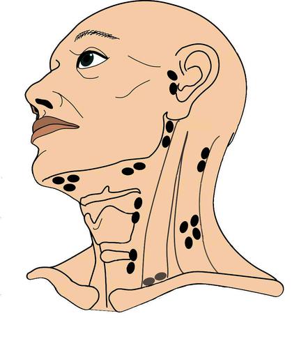 lymfklier in de hals solitair vergroot_kleur (2).jpg