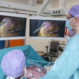 Dezelfde dag naar huis na een maagverkleining dankzij innovatieve pleister