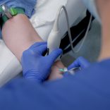 In één keer raak, ook bij moeilijke prikkers