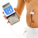 Catharina Ziekenhuis expert in het plaatsen van PEG-sondes