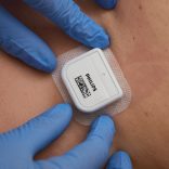 Hoe we onze patiënten thuis blijven begeleiden na een aortaklepoperatie: ‘Fijn dat iemand meekijkt’