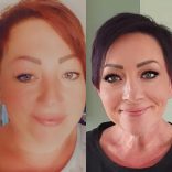 Monika valt na maagoperatie 44 kilo af: ‘Had ik dit maar veel eerder gedaan’