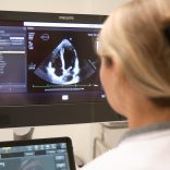 Dit protocol redt levens: sneller medicatie bij hartfalen