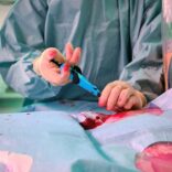 Dit hulpmiddel maakt ablatie comfortabeler voor patiënt: 'Minder last van misselijkheid en pijn’