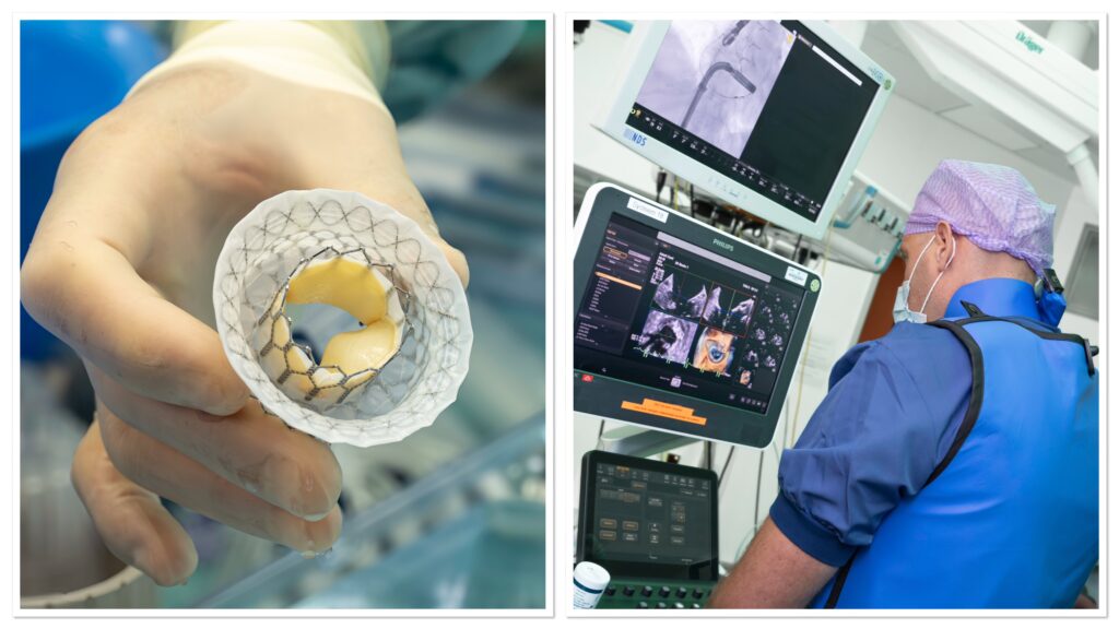 Met behulp van geavanceerde beeldvormingstechnieken begeleidt Sjoerd Bouwmeester het team bij het nauwkeurig implanteren van de nieuwe hartklep. Foto's: Guy van Dael/Catharina Ziekenhuis